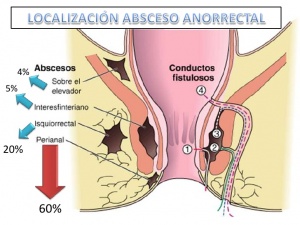 Absceso-perianal.jpg